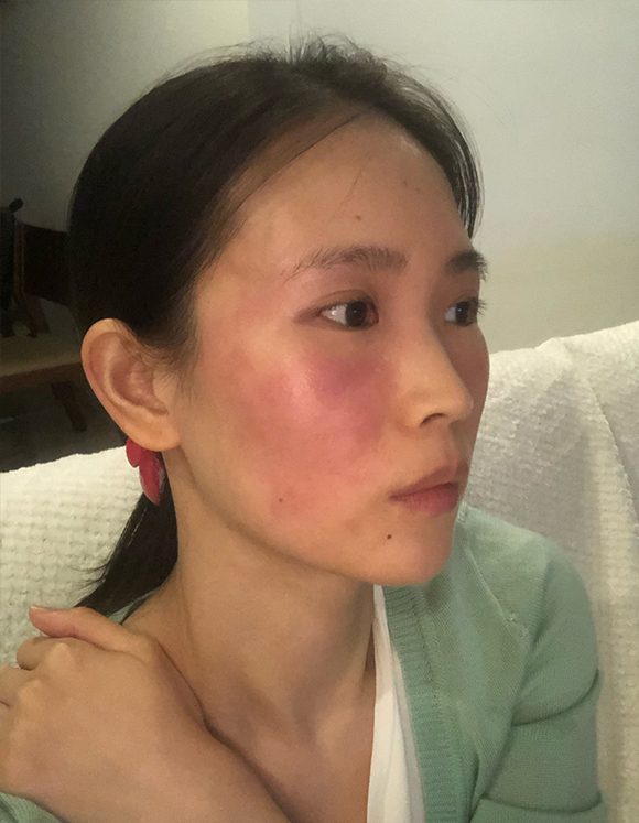 敏感肌护理图片